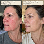Complete Skin Identical Inflammation System