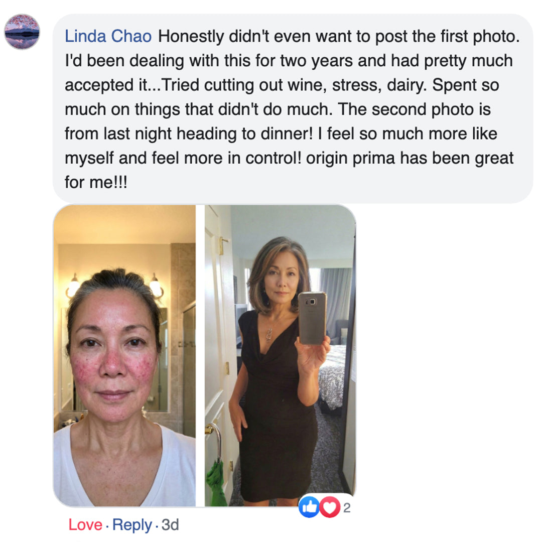 Original Skin System