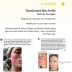 Complete Skin Restoration System r