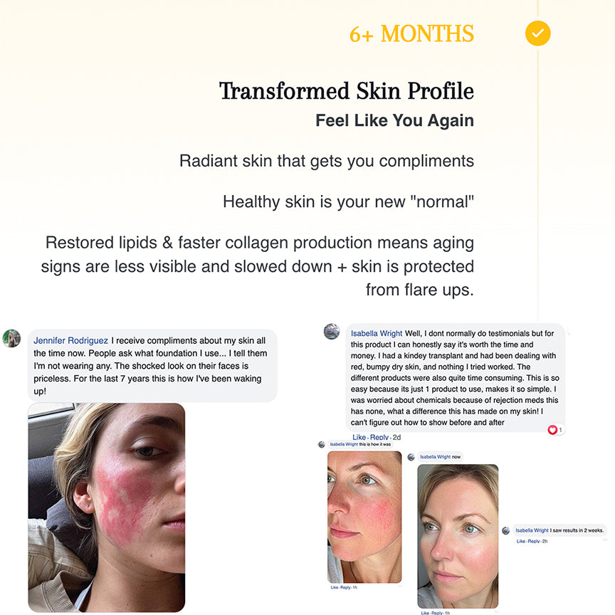 Complete Skin Restoration System r