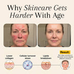 Complete Skin Restoration System r