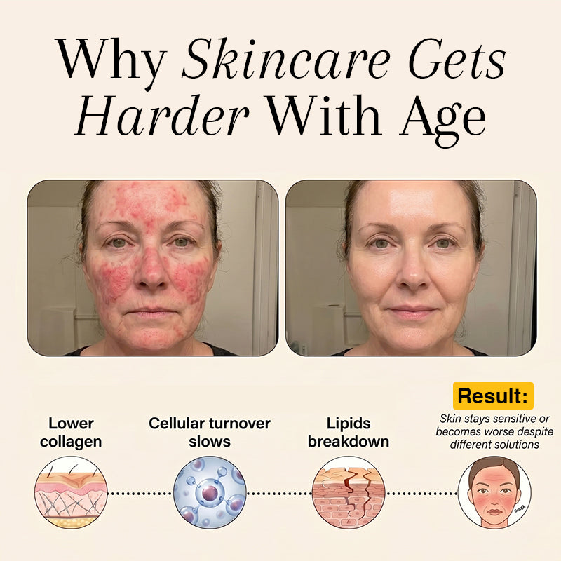 Complete Skin Restoration System r